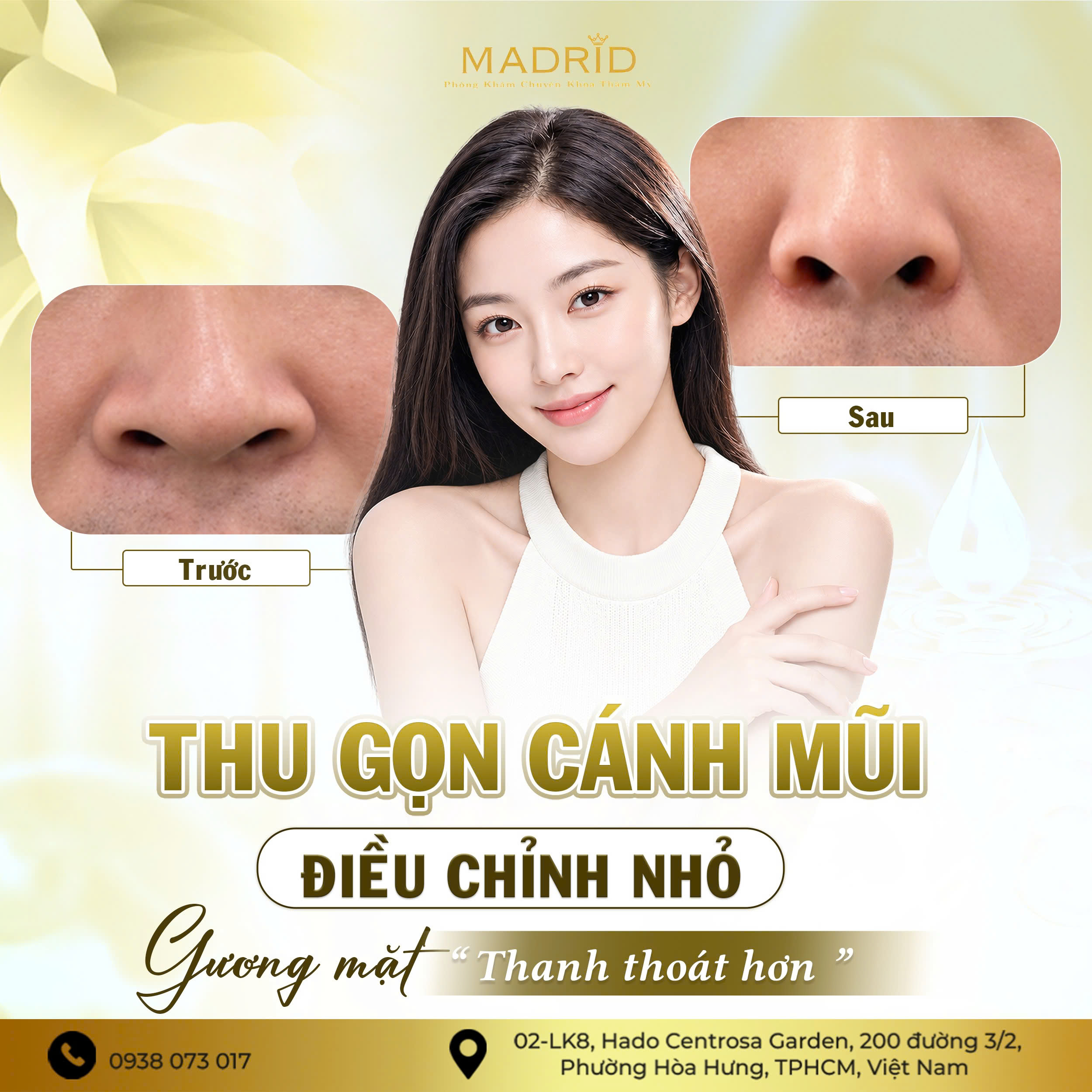 THU GỌN CÁNH MŨI – ĐIỀU CHỈNH NHỎ, GƯƠNG MẶT THANH THOÁT HƠN