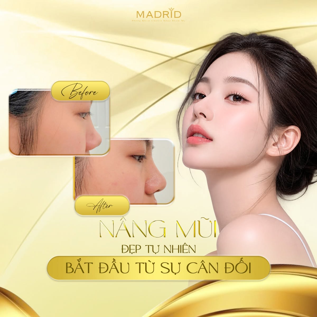 NÂNG MŨI – ĐẸP TỰ NHIÊN BẮT ĐẦU TỪ SỰ CÂN ĐỐI