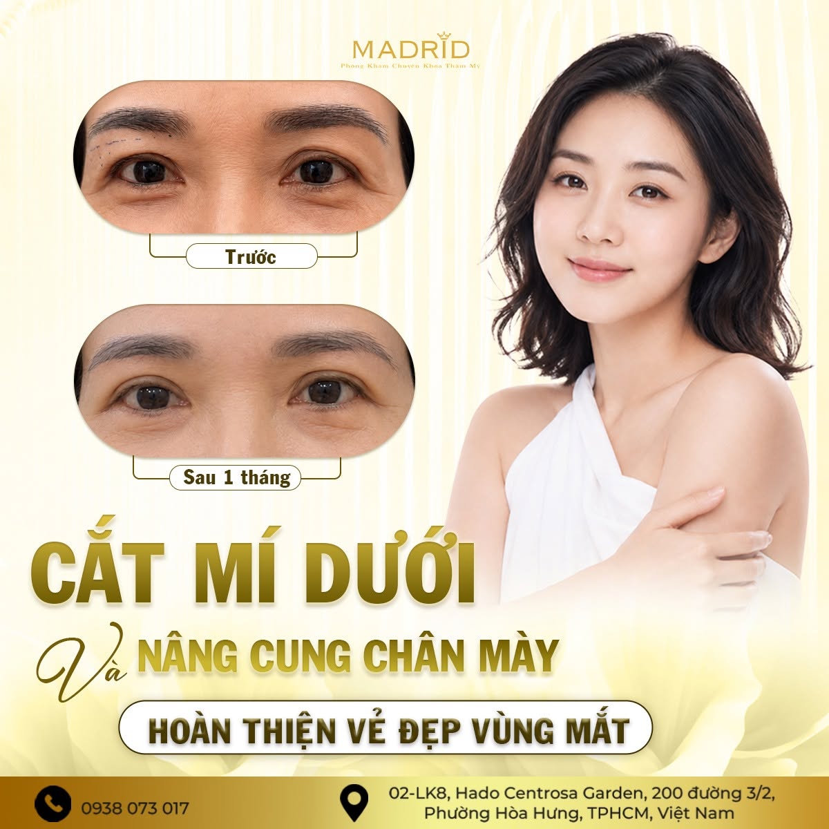 CẮT MÍ DƯỚI & NÂNG CUNG CHÂN MÀY – HOÀN THIỆN VẺ ĐẸP VÙNG MẮT