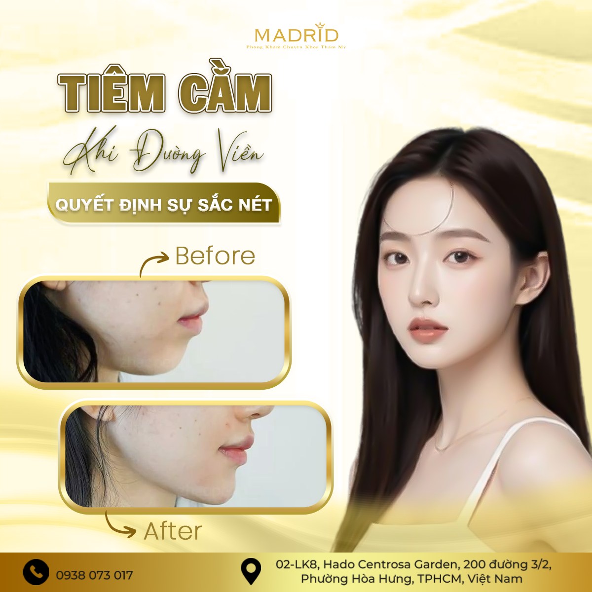 TIÊM CẰM – KHI ĐƯỜNG VIỀN QUYẾT ĐỊNH SỰ SẮC NÉT