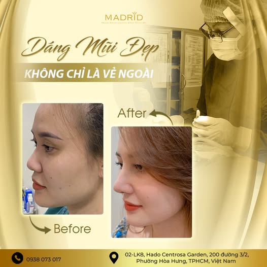 DÁNG MŨI ĐẸP KHÔNG CHỈ LÀ VẺ NGOÀI