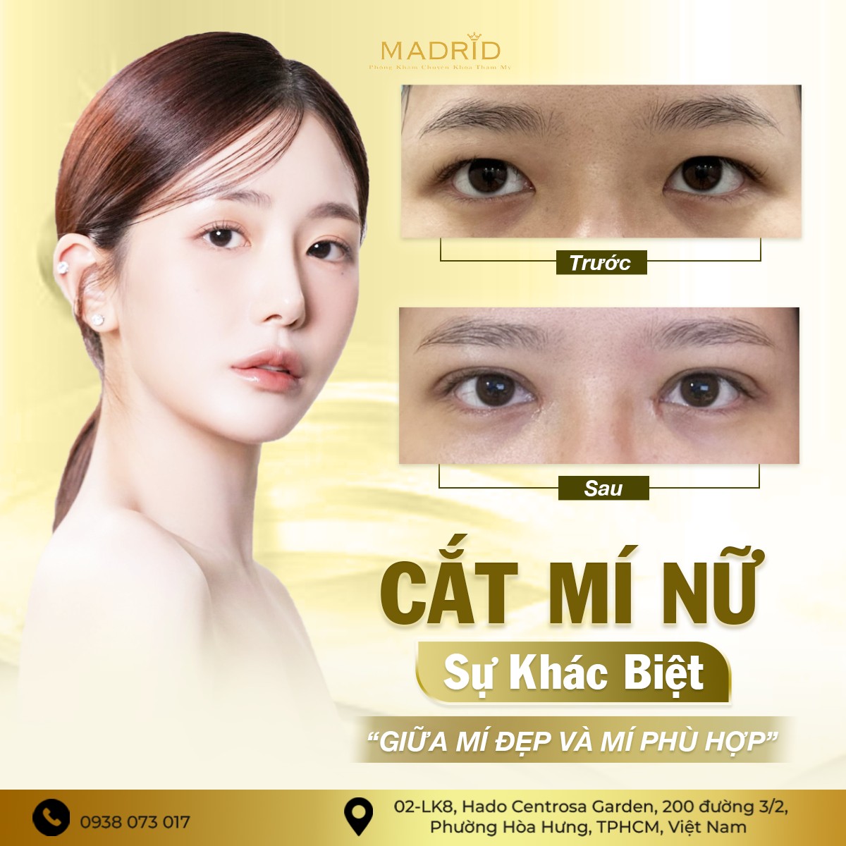 CẮT MÍ NỮ – SỰ KHÁC BIỆT GIỮA MÍ ĐẸP VÀ MÍ PHÙ HỢP