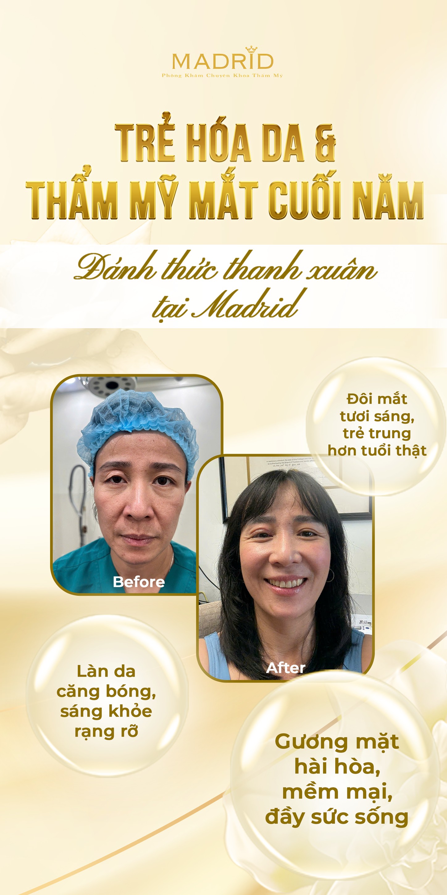 HÀNH TRÌNH THAY ĐỔI NHAN SẮC TẠI MADRID – TỰ TIN TỪ NHỮNG CHI TIẾT NHỎ NHẤT