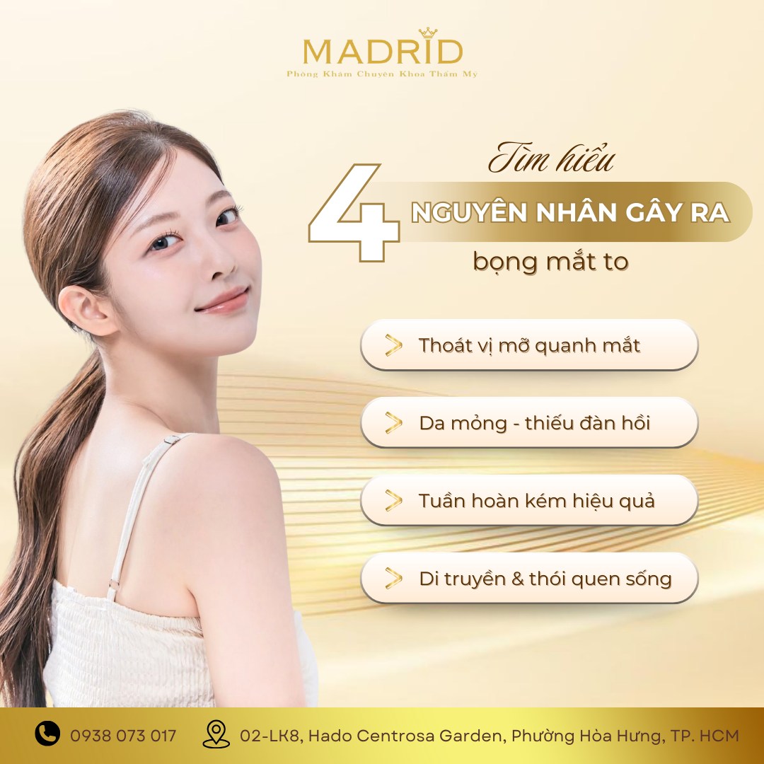 NGUYÊN NHÂN BỌNG MẮT TO