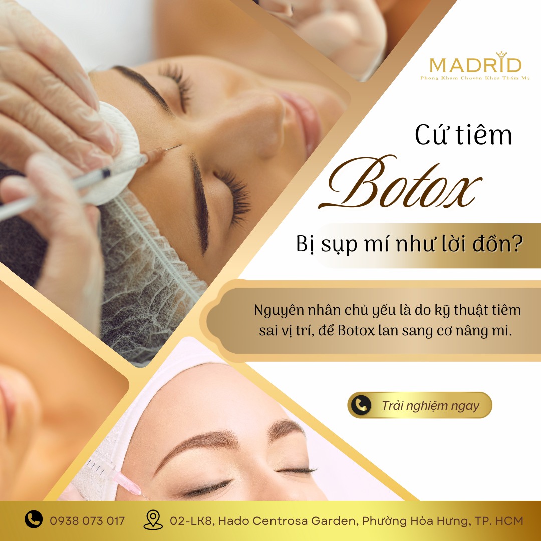 CỨ TIÊM BOTOX LÀ BỊ SỤP MÍ NHƯ LỜI ĐỒN?
