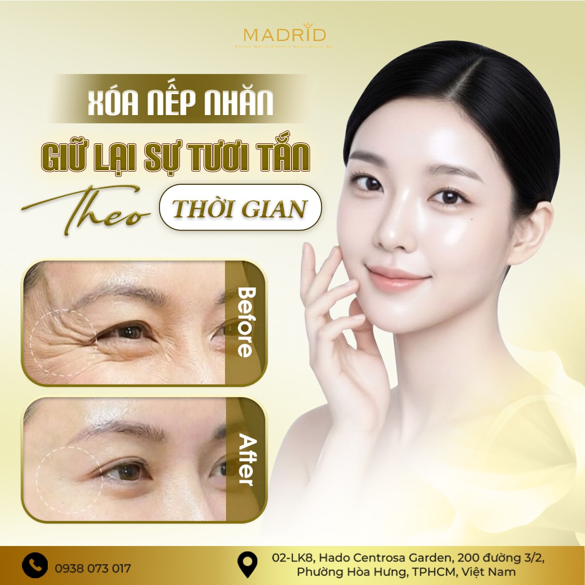 XÓA NẾP NHĂN – GIỮ LẠI SỰ TƯƠI TẮN THEO THỜI GIAN