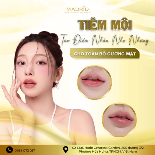 TIÊM MÔI – TẠO ĐIỂM NHẤN NHẸ NHÀNG CHO TOÀN BỘ GƯƠNG MẶT