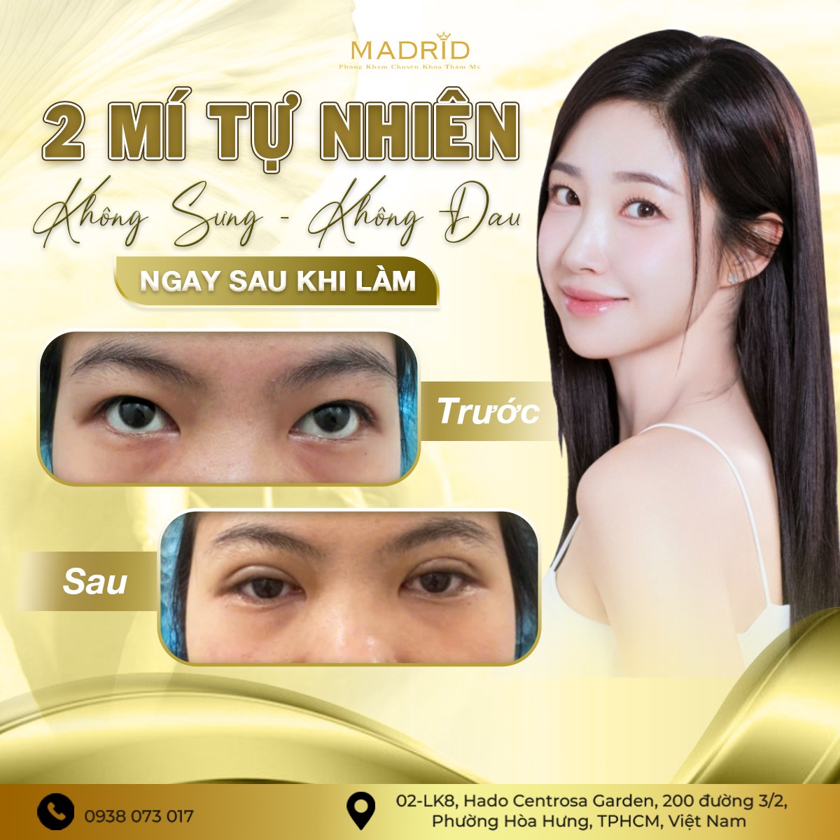 2 MÍ TỰ NHIÊN KHÔNG SƯNG, KHÔNG ĐAU – NGAY SAU KHI LÀM