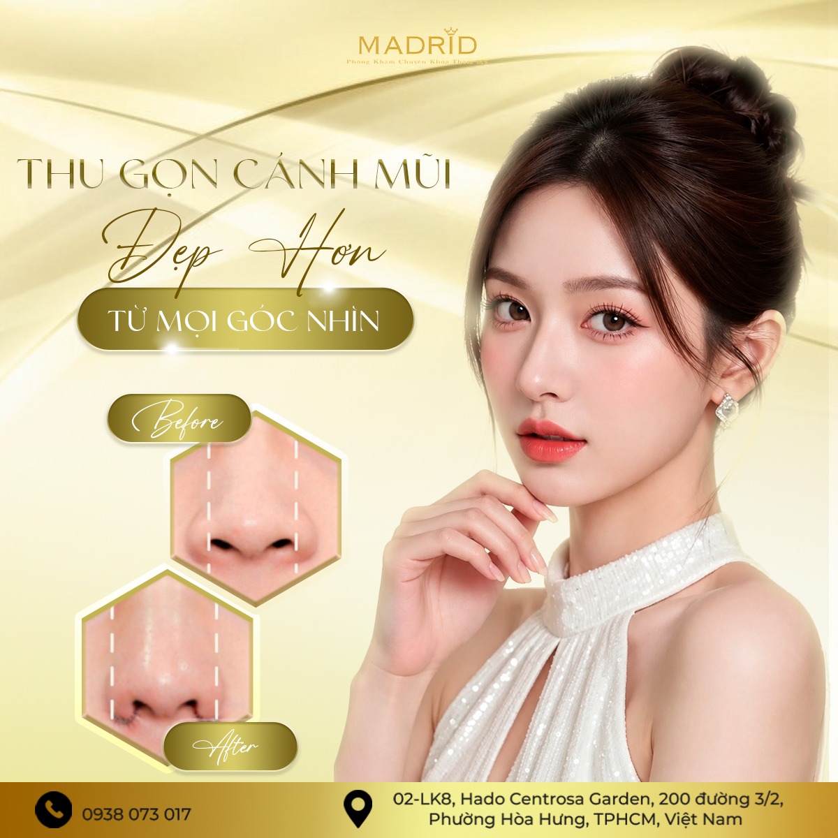THU GỌN CÁNH MŨI – ĐẸP HƠN TỪ MỌI GÓC NHÌN