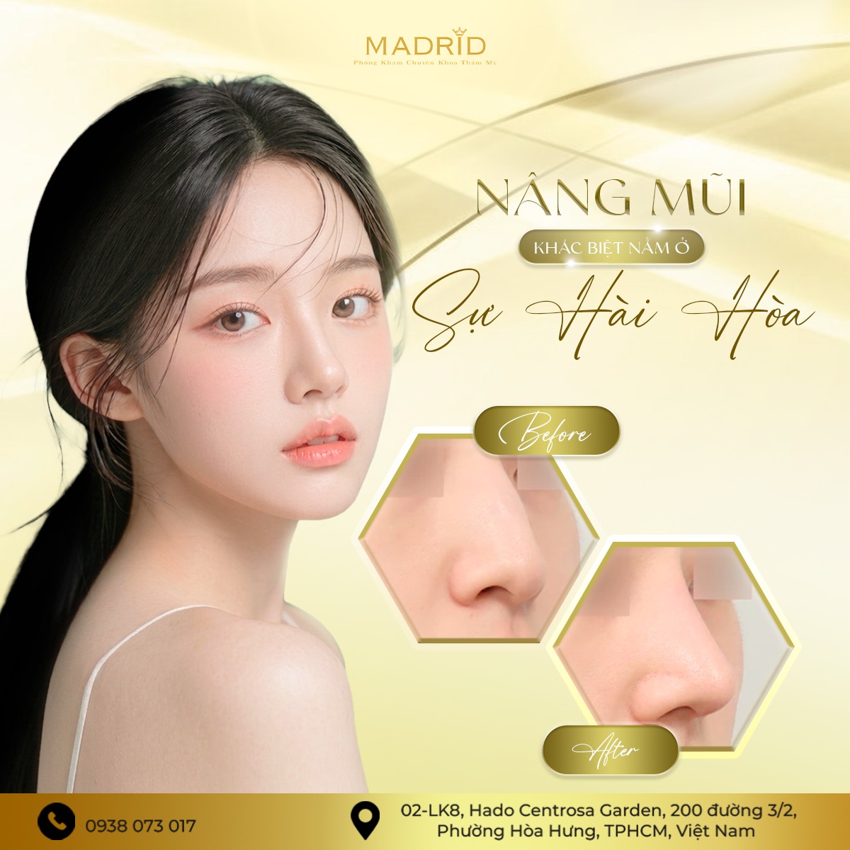 TIÊM FILLER MŨI – TINH CHỈNH NHẸ ĐỂ SỐNG MŨI THANH THOÁT HƠN