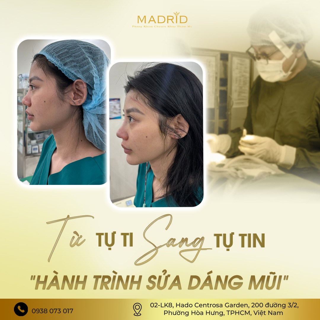 TỪ TỰ TI SANG TỰ TIN - HÀNH TRÌNH SỬA DÁNG MŨI