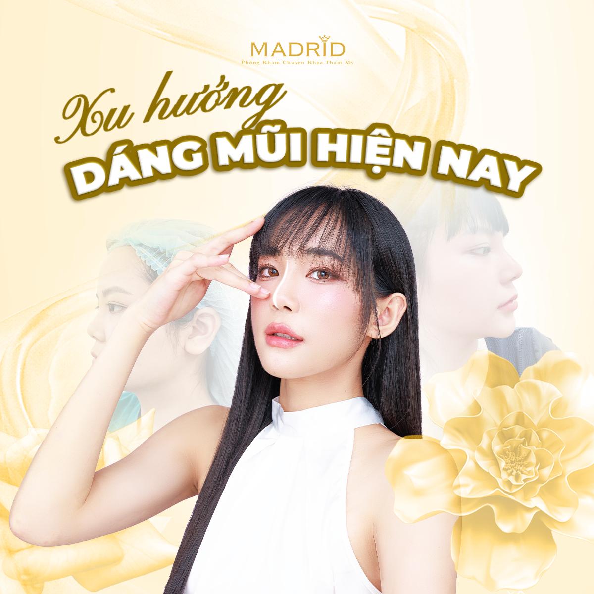 DÁNG MŨI XINH ĐÓN GIÁNG SINH